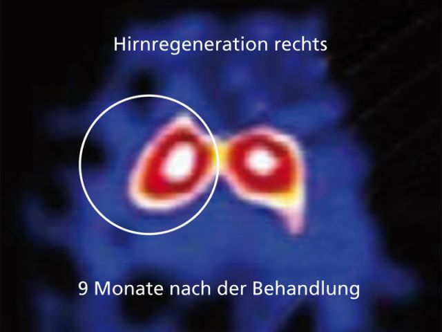 DaTSCAN von Enrico S.