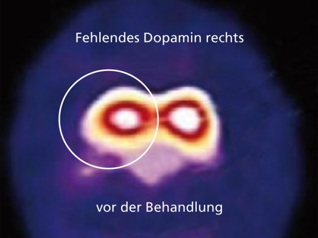 DaTSCAN von Enrico S.